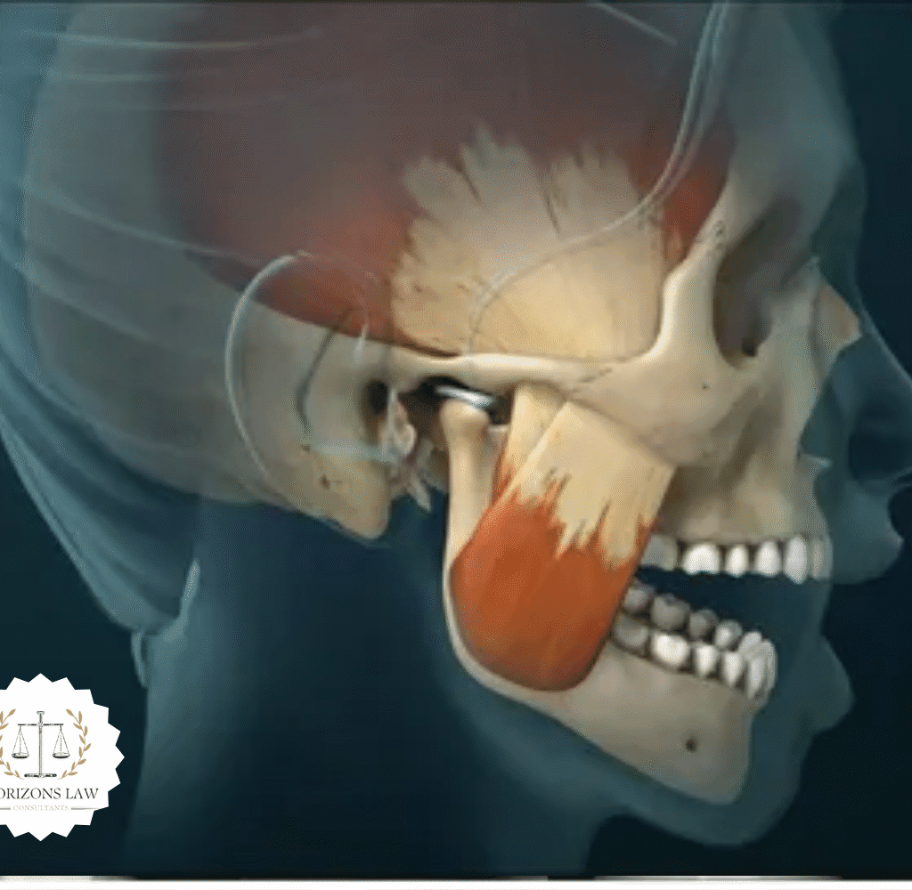 Tmj Injuries 16 Common Auto Accident Injuries: Full Guide 2025